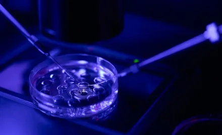 Injection Intracytoplasmique de Spermatozoïde (ICSI)