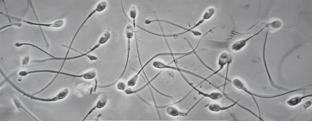 Technique IMSI et Fécondation in Vitro