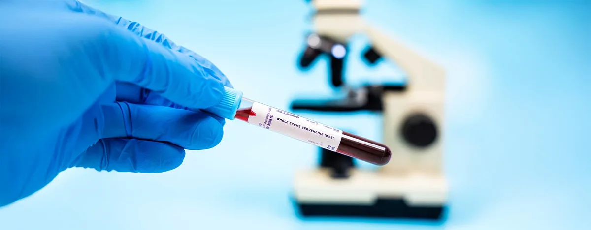 Séquençage de l’Exome Complet (WES)